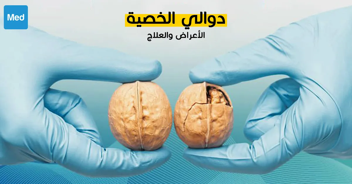 دوالي الخصية : الأعراض والعلاج